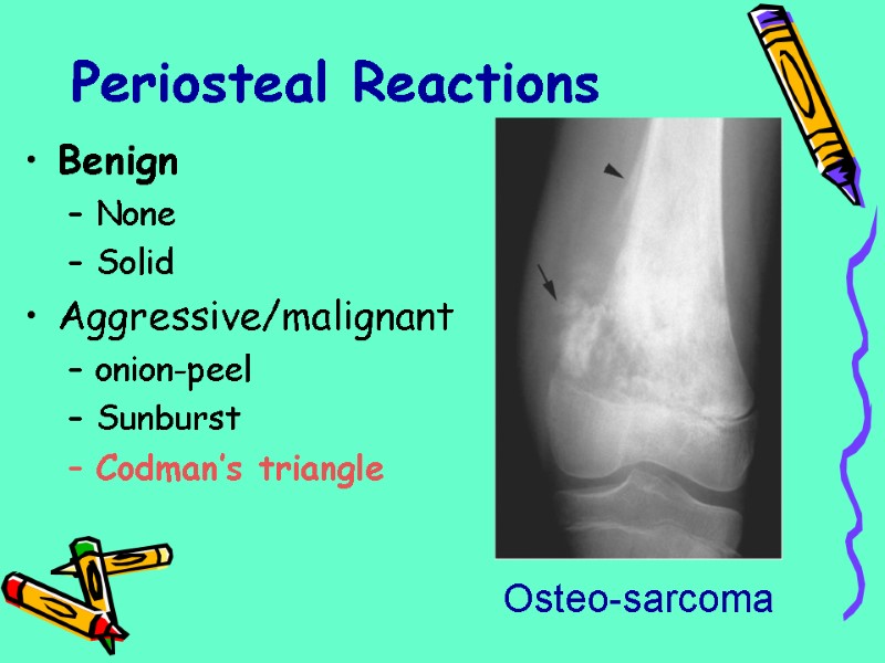 Periosteal Reactions Benign None Solid Aggressive/malignant onion-peel Sunburst Codman’s triangle Osteo-sarcoma